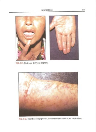 Lecciones de Dermatología