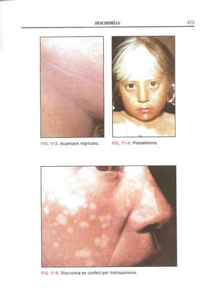 Lecciones de Dermatología