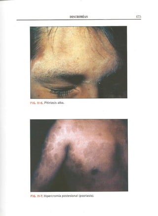 Lecciones de Dermatología