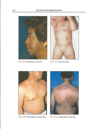 Lecciones de Dermatología