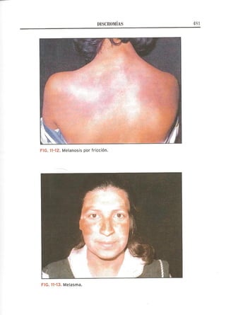 Lecciones de Dermatología