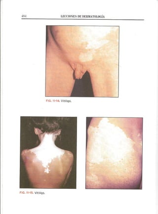 Lecciones de Dermatología