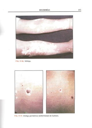 Lecciones de Dermatología