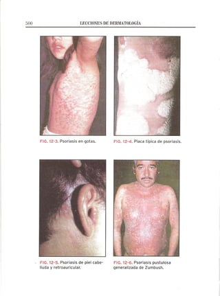 Lecciones de Dermatología