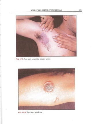 Lecciones de Dermatología