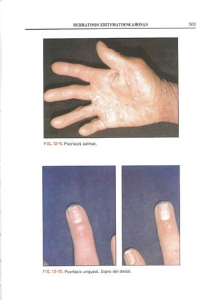 Lecciones de Dermatología