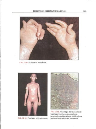 Lecciones de Dermatología