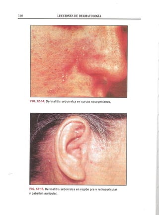 Lecciones de Dermatología