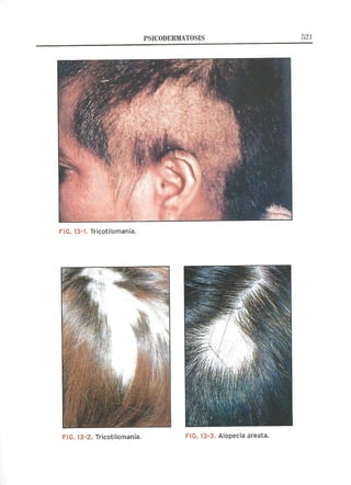 Lecciones de Dermatología