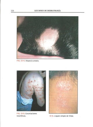 Lecciones de Dermatología