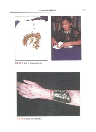 Lecciones de Dermatología