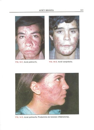 Lecciones de Dermatología