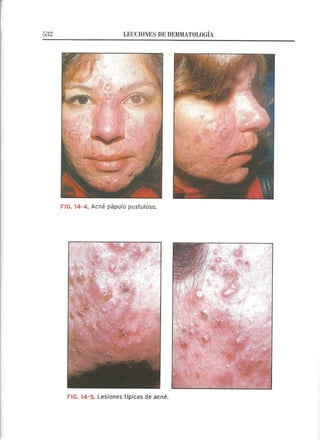 Lecciones de Dermatología