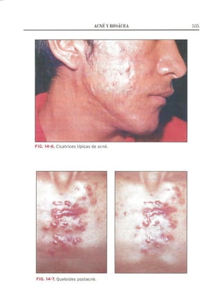 Lecciones de Dermatología