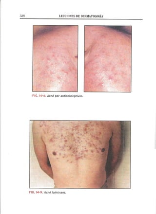 Lecciones de Dermatología