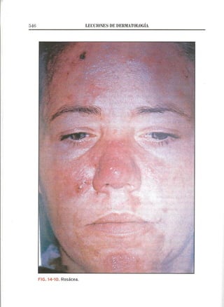 Lecciones de Dermatología