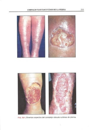 Lecciones de Dermatología