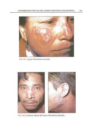 Lecciones de Dermatología