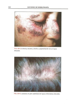 Lecciones de Dermatología