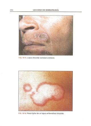 Lecciones de Dermatología