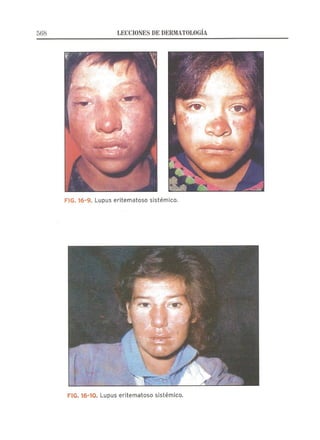 Lecciones de Dermatología