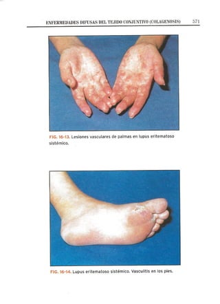 Lecciones de Dermatología