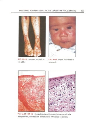 Lecciones de Dermatología