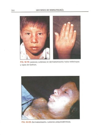 Lecciones de Dermatología