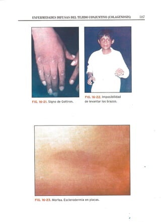 Lecciones de Dermatología