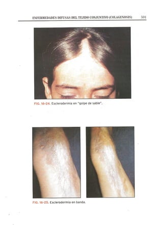 Lecciones de Dermatología