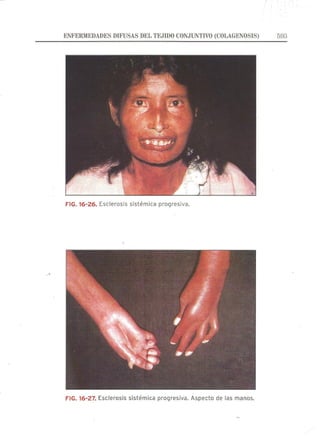 Lecciones de Dermatología