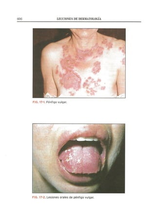 Lecciones de Dermatología