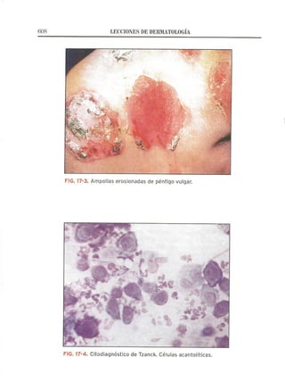 Lecciones de Dermatología