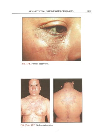 Lecciones de Dermatología