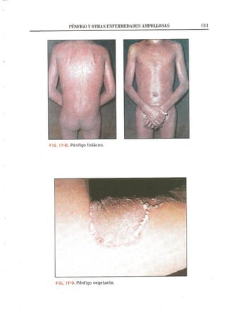 Lecciones de Dermatología