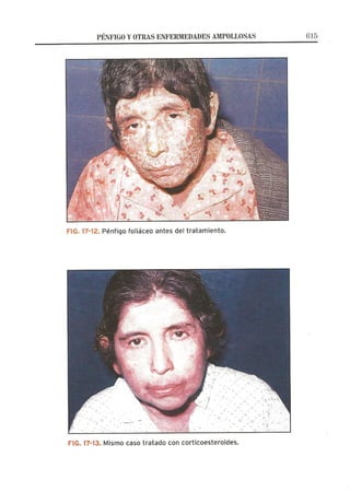 Lecciones de Dermatología