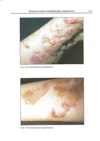 Lecciones de Dermatología