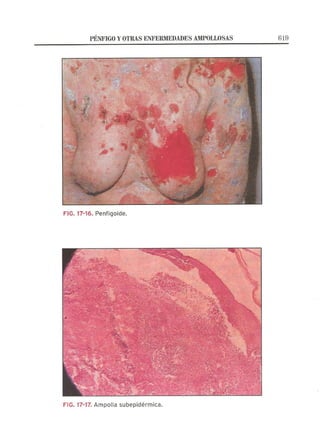 Lecciones de Dermatología