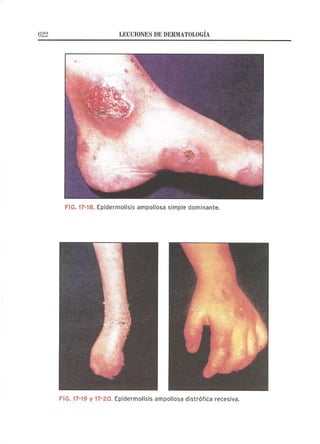 Lecciones de Dermatología