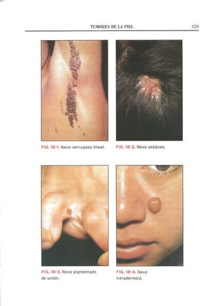 Lecciones de Dermatología