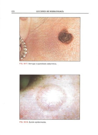 Lecciones de Dermatología