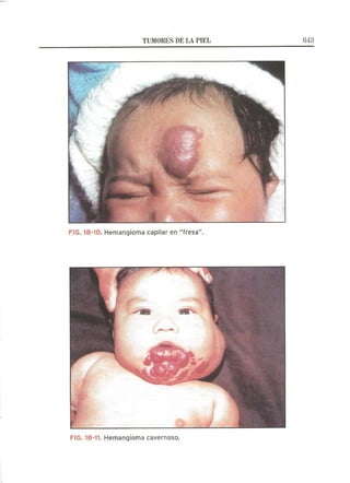 Lecciones de Dermatología