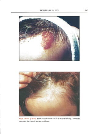 Lecciones de Dermatología