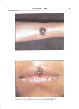 Lecciones de Dermatología