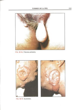 Lecciones de Dermatología