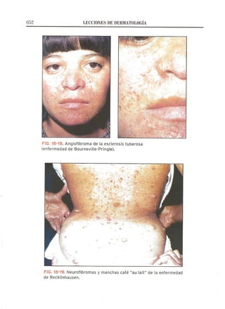 Lecciones de Dermatología