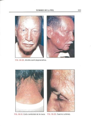 Lecciones de Dermatología