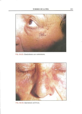 Lecciones de Dermatología