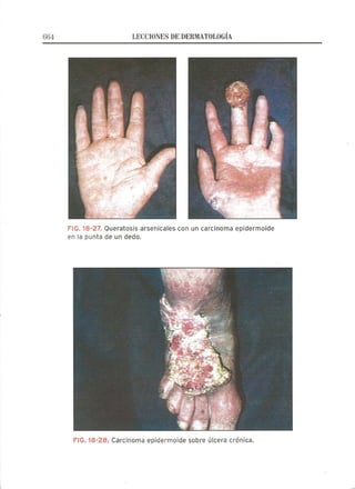 Lecciones de Dermatología