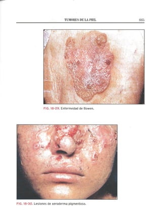 Lecciones de Dermatología